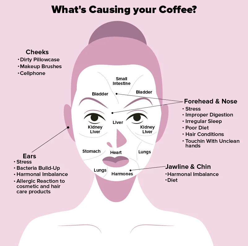 What Causes Forehead Acne