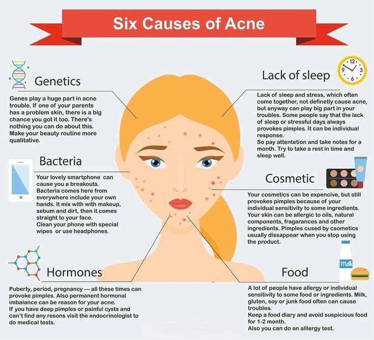 Can Lack Of Sleep Cause Acne