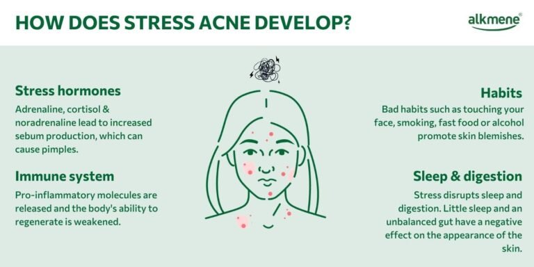 Can Stress Cause Acne