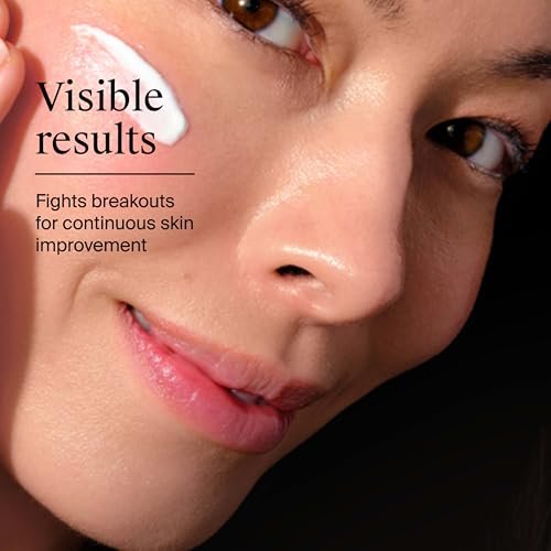 Best Acne Spot Treatment