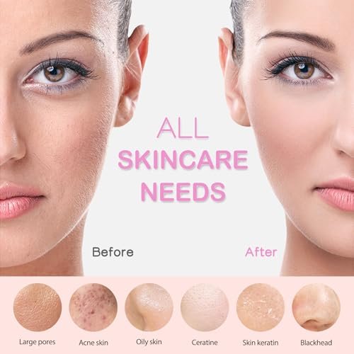 Best Facial Cleansing Device