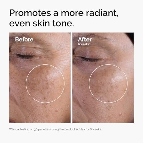 Best Exfoliating Toner