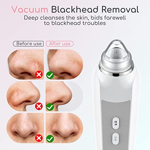 Best Blackhead Remover Machine