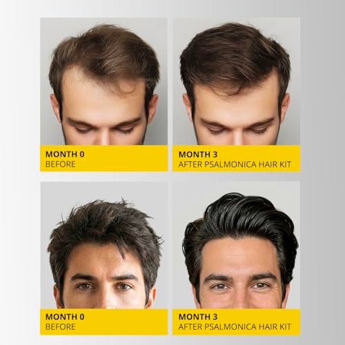 Best Shampoo For Thinning Hair