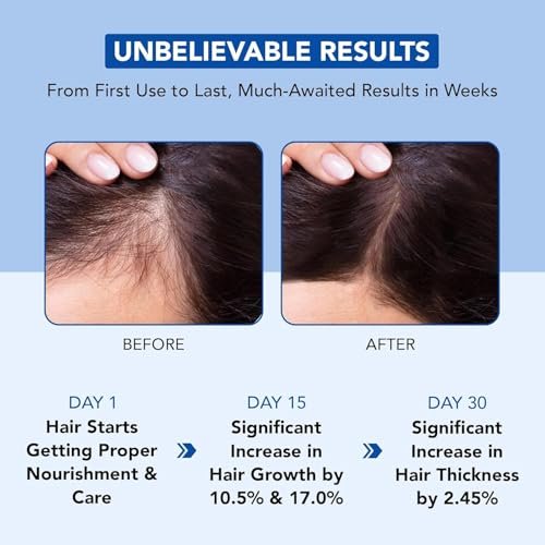 Best Rosemary Hair Oil