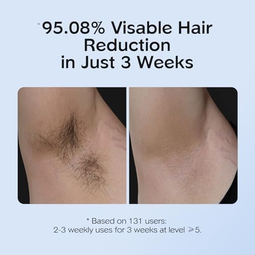 Best Ipl Hair Removal Device
