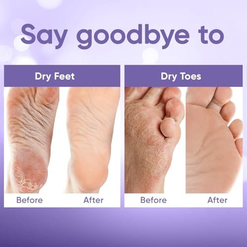 Best Exfoliating Foot Mask