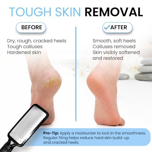 Best Pedicure Foot File