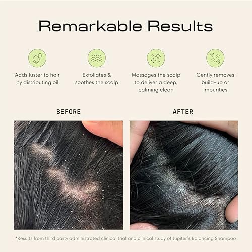 Best Scalp Scrubber