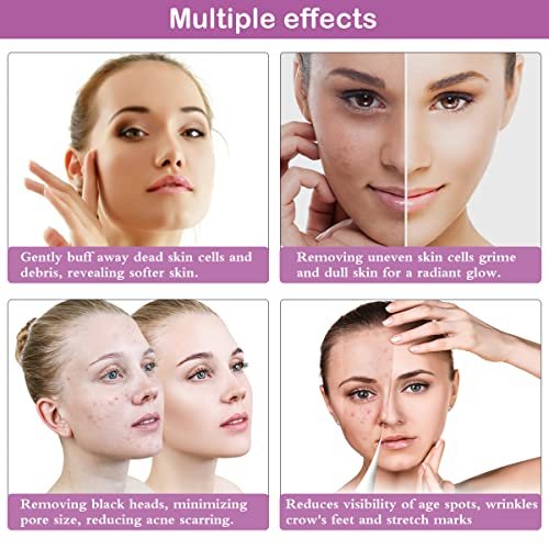Best Microdermabrasion Machine