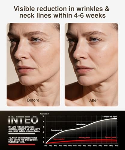 Best Red Light Therapy Mask