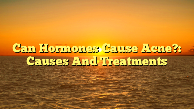 Can Hormones Cause Acne?: Causes And Treatments