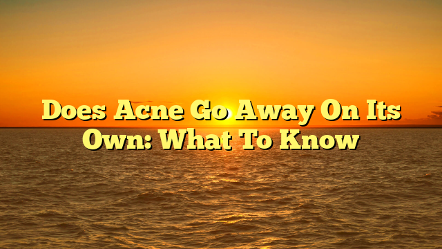 Does Acne Go Away On Its Own: What To Know