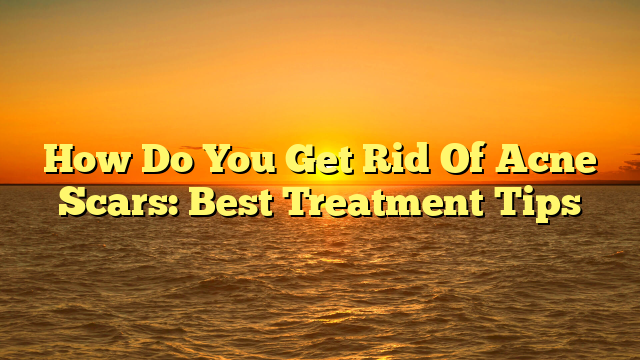 How Do You Get Rid Of Acne Scars: Best Treatment Tips