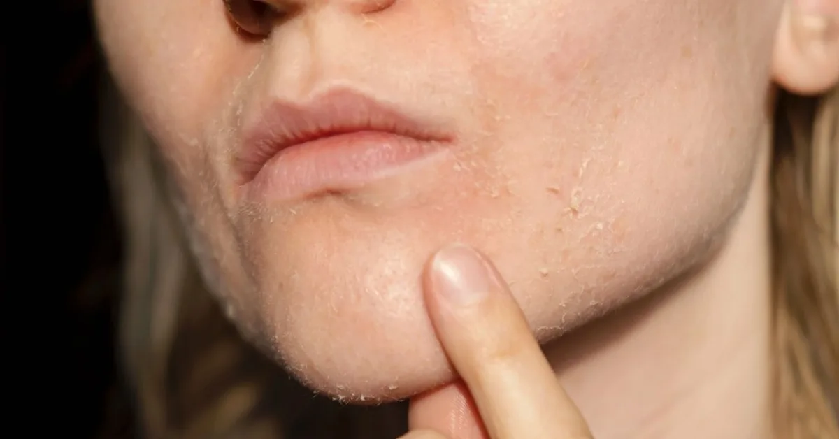 Combination Skin