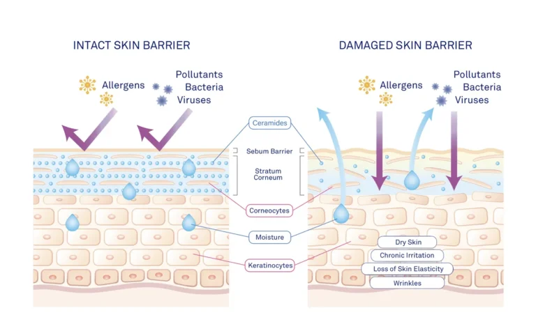Damaged Skin Barrier Repair