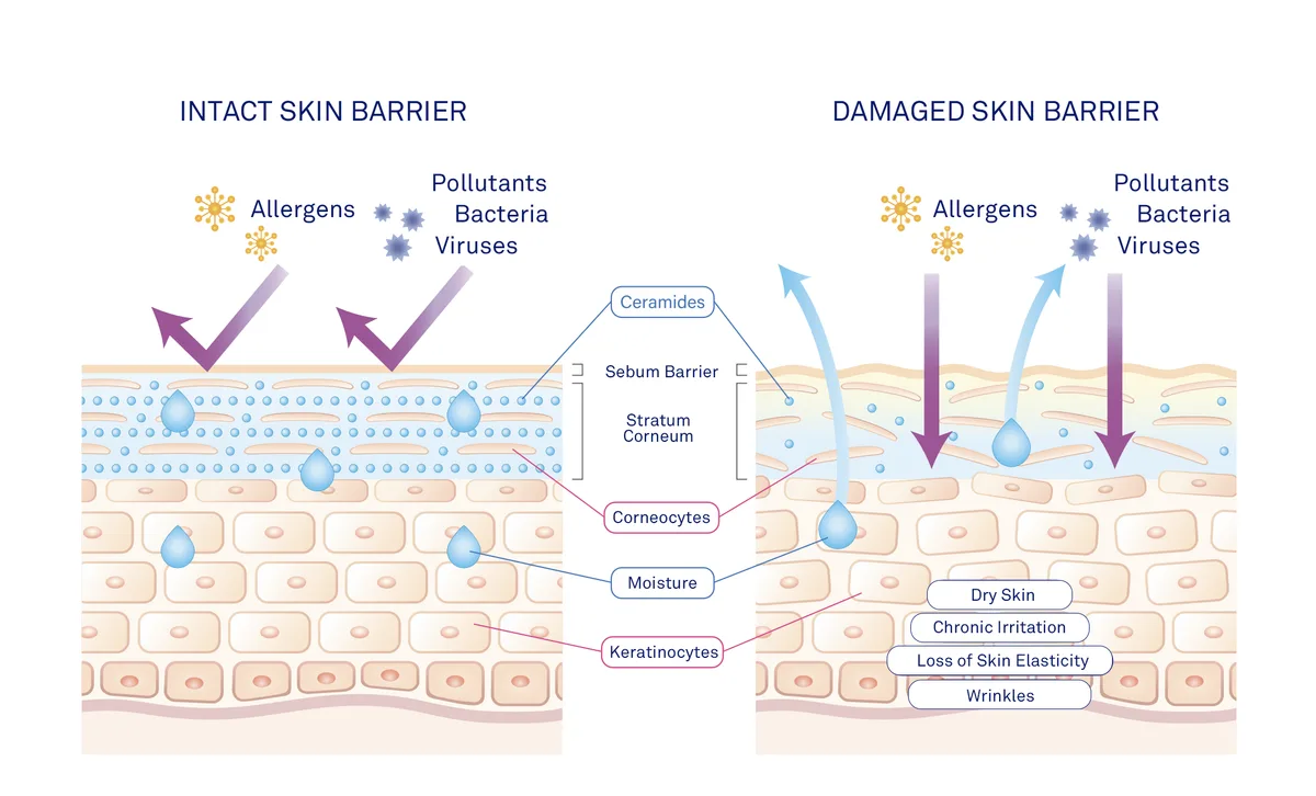 Damaged Skin Barrier Repair
