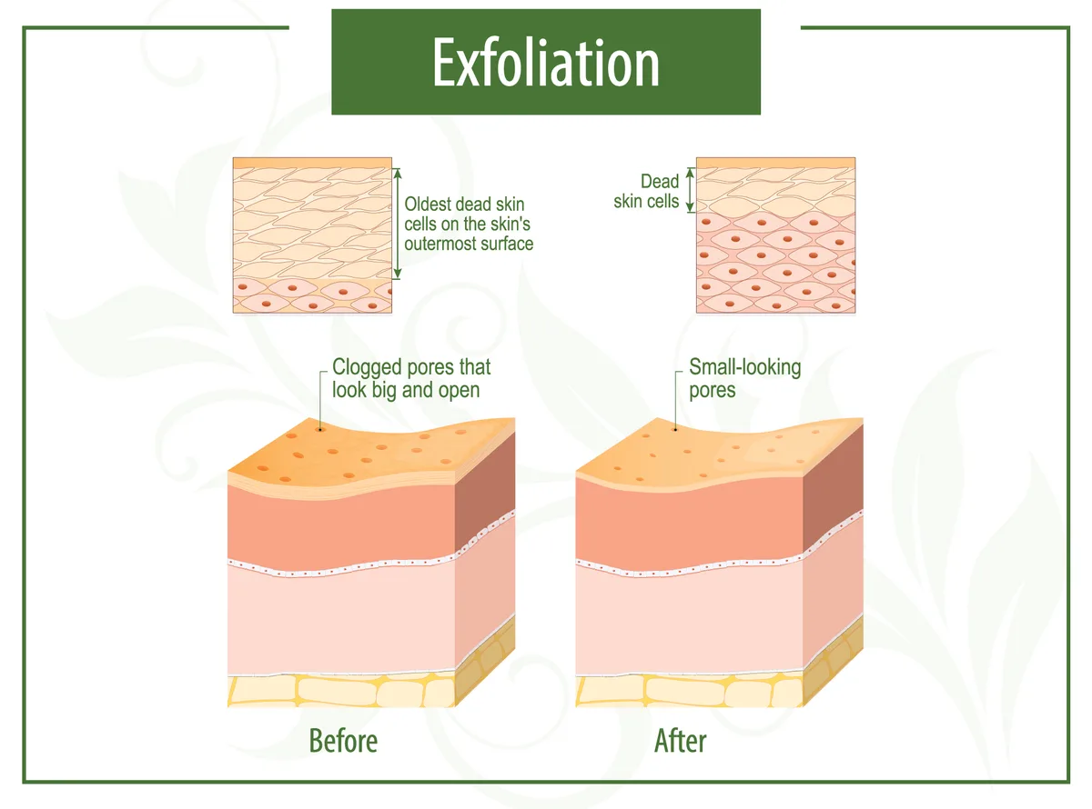 Exfoliating Acids: Proceed with Caution