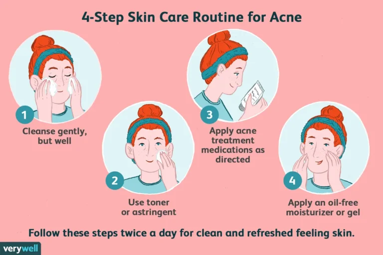 How can I care for sensitive acne-prone skin?