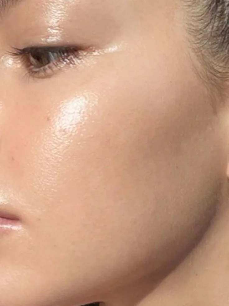 How can I improve my skin naturally?