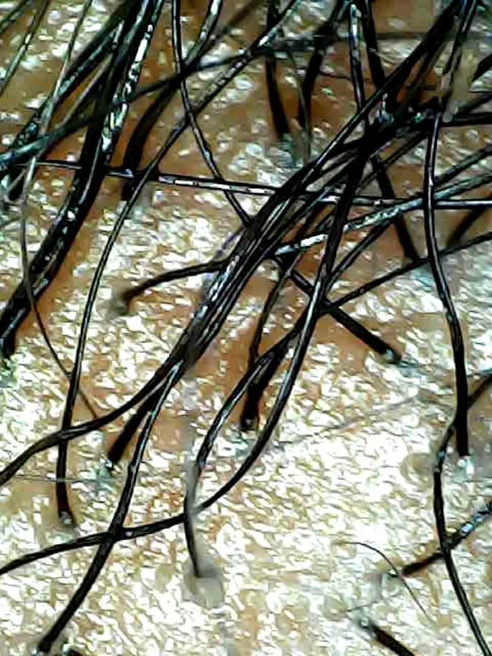 Oily Scalps and Fine Hair Needs