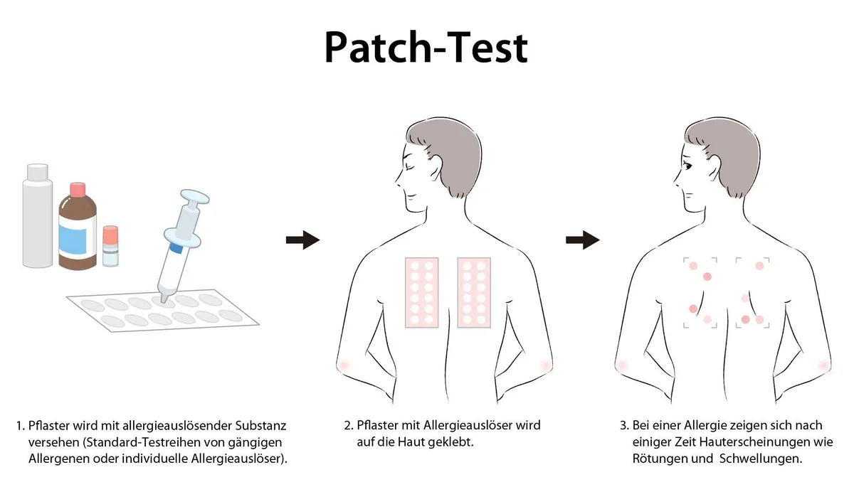 Patch Testing