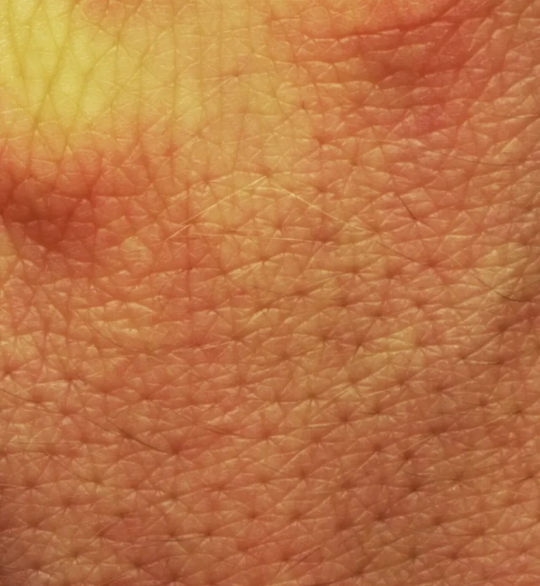 Pore size appearance