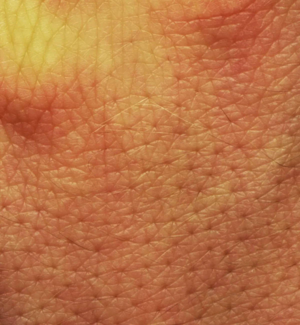 Pore size appearance