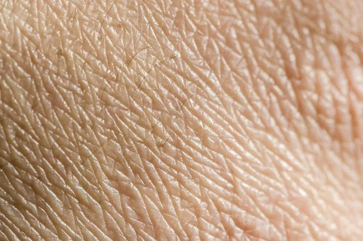 Recurring breakouts