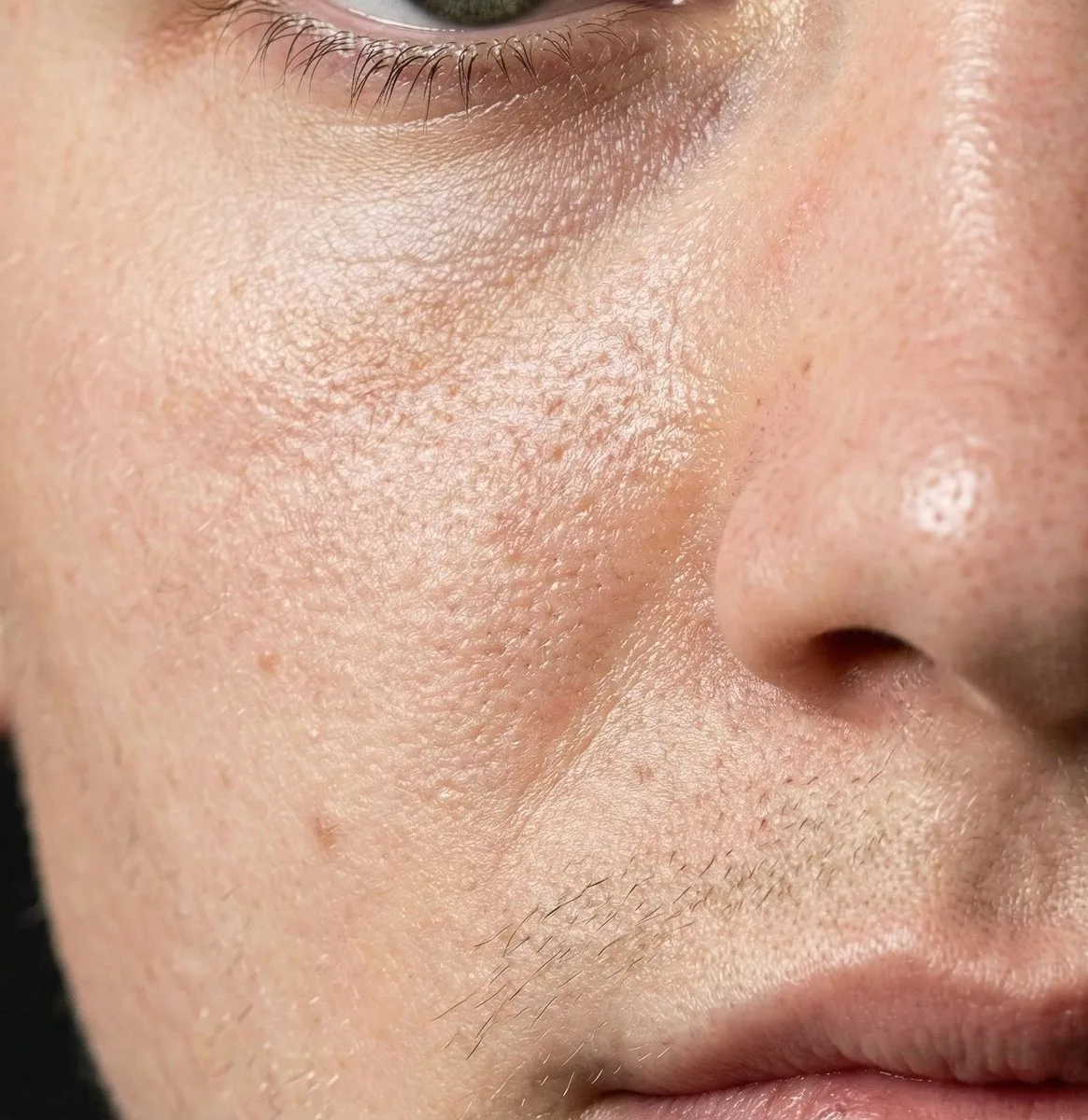 Why do my pores look so large?